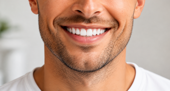 How Often Should You Get Your Teeth Professionally Cleaned?